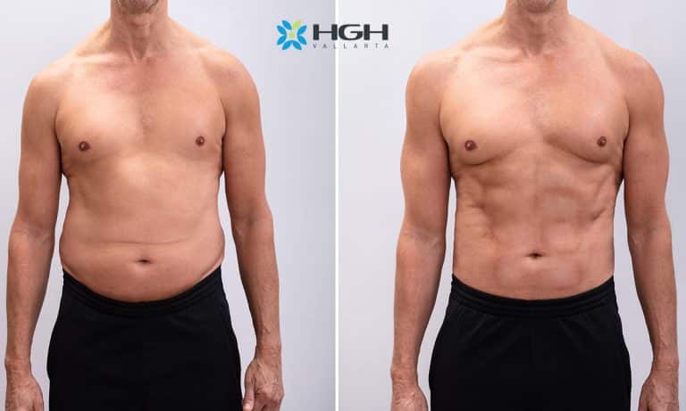 Real-Life HGH Before and After Results | HGH Vallarta Clinic