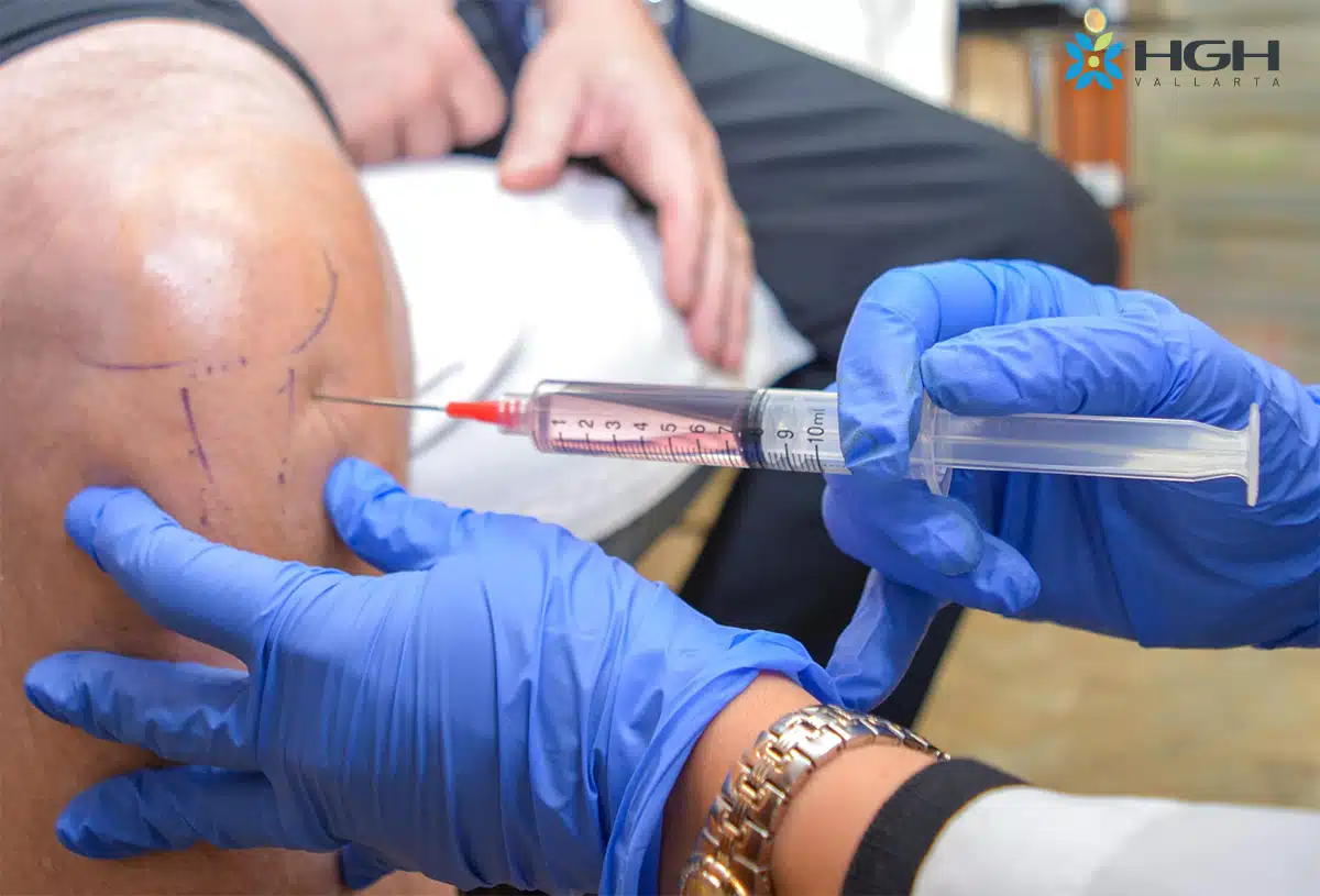 Stem Cell Injection into Knee