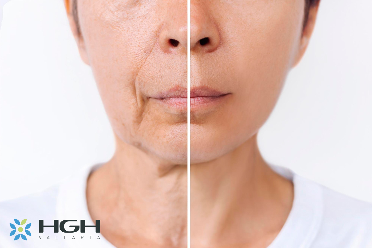 4 HGH Before and After Face Transformation