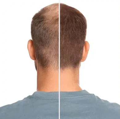 main with thinning hair and thick hair before and after.png e1736853448559