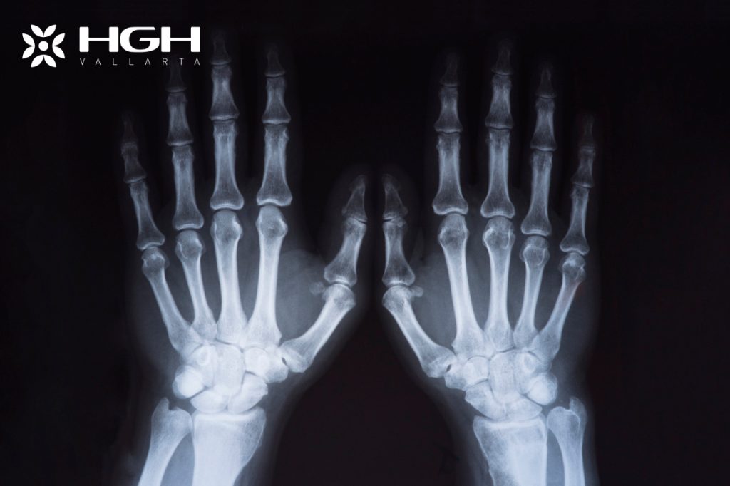 Understanding Growth Hormone Therapy: A Parent-Friendly Case Review of a 15-Year-Old’s Progress 1 2